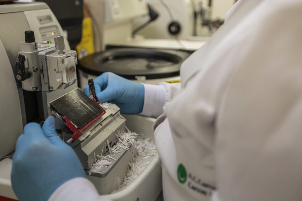 Mãos de profissional de saúde com luvas azuis operando equipamento de laboratório para diagnóstico de câncer.