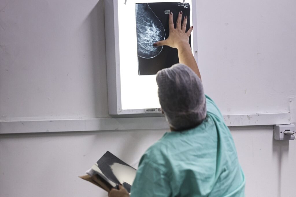 mamografia digital: Profissional de saúde analisa chapa de exame em negatoscópio.